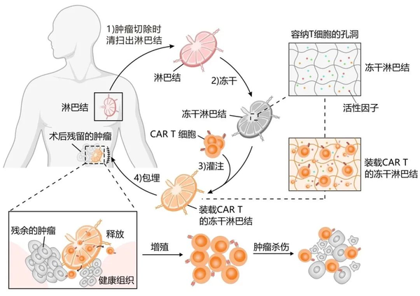 凍干淋巴結(jié)遞送CAR T細(xì)胞治療腫瘤示意圖.png